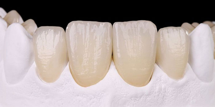 Методы восстановления зубного ряда